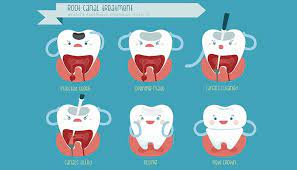 The most common source of pain after root canal treatment is inflammation of the tissues that surround the tooth's root (termed periradicular inflammation). Why Am I Experiencing Pain After Root Canal Treatment