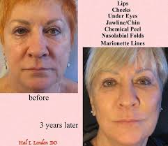 ✨ Real Transformations Natural-Looking Results with Dr. William, enhance  your figure without losing your essence. 📍 Book your appointment today. 🌐  www.drwilliamparada.com #mommymakeoversurgery #CosmeticSurgery #liposuction  #tummytucksurgery ...