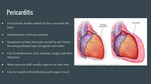 • acute coronary syndrome • acute pericarditis • acute respiratory distress. All Things Heart Ppt Download