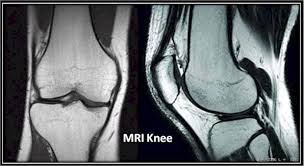 In other cases, it might take a few days. Swslhd Medical Imaging Mri Knee
