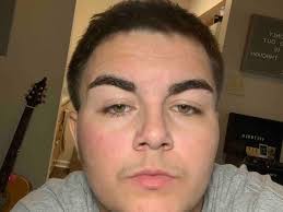 Fundraiser by Daniel Casner : Daniels Top Surgery