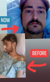 Thank you god for another chance ! 🦿🍾🙏🏿