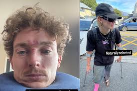 5 Riders Out at Natural Selection Bike After Practice Injuries