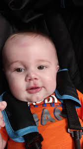 Surfer injured while surfing this morning