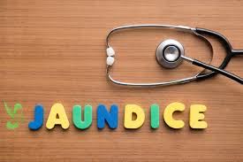 Jaundice కామెర్ల వ్యాధి Mathrusree Ayurveda