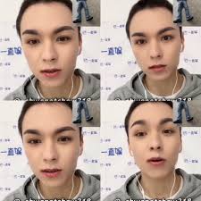 can we all talk about vernon's braces era? he's so gwapoooo