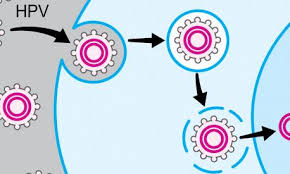 These cancers are called oropharyngeal cancers. how does hpv cause cancer? Hpv Associated Oral And Throat Cancer What You Need To Know My Mooc