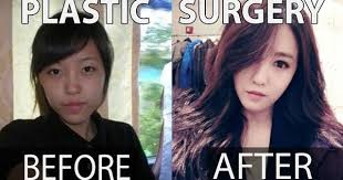10 Kpop Stars Before And After Plastic Surgery Misup Plastic Surgery Surgery Double Jaw Surgery