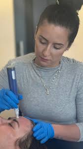 Struggling with acne scars? You’re not alone! SkinPen + PRP at Wellness  District is clinically backed to soften scarring, smooth texture, and boost  confidence with minimal downtime., It’s not ...