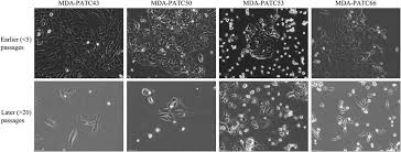 Two-dimensional culture of human pancreatic adenocarcinoma cells results in  an irreversible transition from epithelial to mesenc
