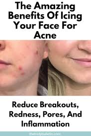 Pin On Skin Care