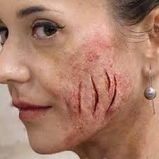 Unpainted Silicone Eye Socket Burn Prosthetic (unpainted) Cosplay, LARP,  Sfx, Halloween, Freddy Krueger