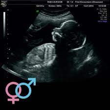 Gender Scans: Should I Find Out The Sex Of My Baby?