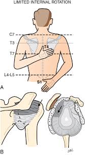 Image result for Rotator Cuff Triad Test