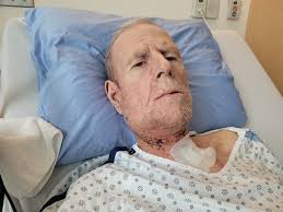 Lingering On The Edge of the Abyss