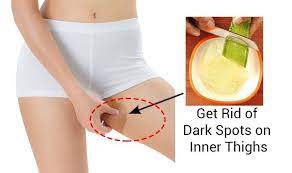 Free shipping & free returns. How To Lighten Your Dark Inner Thighs Naturally Top 10 Home Remedies Dark Inner Thigh How To Lighten Inner Thigh