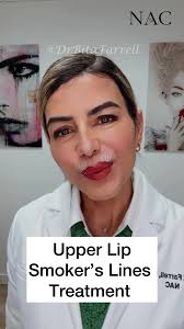 #smokerslines #smokerslinestreatment #lipsticklines #drbitafarrell  #naturalaestheticscenter