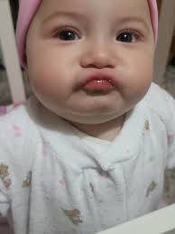 Bebé tomándose su medicina: un momento divertido