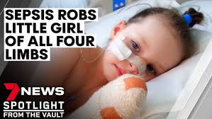 Saving Mia: six-year old left quadruple amputee following sepsis battle