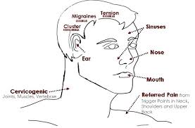 Types Of Headaches Chart Jasonkellyphoto Co