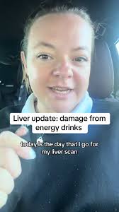 Drinks A Redbull Every Day I Posted An Update