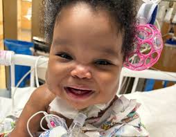 People say there is no pain...