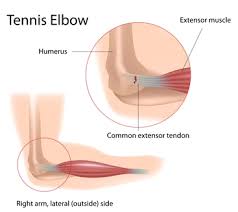 In addition, if other treatments leave you feeling more pain for awhile, this is a what would you prefer, months under pain pills, seeing a doctor who can't really fix the problem? Should You See A Chiropractor For Sports Injuries Success Chiropractic Services