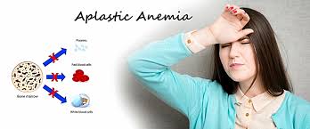 Pengobatan Alami Ini Mampu Menyembuhkam Penyakit Anemia Aplastik