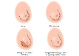 Pin On Health Prevention