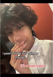 and then i သွေးထွက် after #fyp #foryou #tiktokmyanmar #09 #foryoupage  #relatable