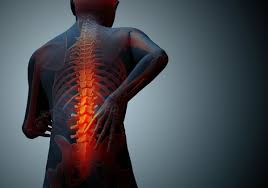 $100,000 settlement for lower back pain from car accident (miami) keith was driving of a car in coconut grove, miami, florida. Workers Compensation St Louis Back Injury Lawyers Back Injury