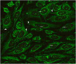 Image result for ANA Staining Pattern