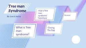 It was originally described by ernest arthur freeman and joseph harold sheldon in 1938.:577. Treeman Syndrome By Lexi Renton