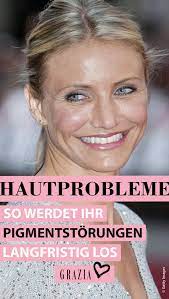 diese produkte helfen wirklich bei pigmentflecken pigmentflecken olige haut haut