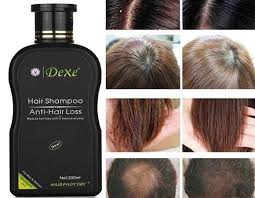 It also has biotin which acts directly on the keratin structure of hair increasing elasticity and vitality. Best Anti Hair Fall Tips You Must Follow Hairstylesvila Herbal Hair Growth Anti Hair Loss Hair Growth Treatment