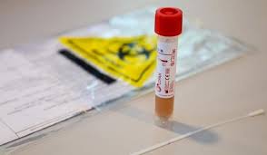 Covid 19 Test Can Be Quite Uncomfortable According To One Local Doctor Trp
