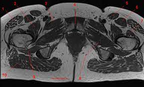 We did not find results for: Mri Of The Hip Detailed Anatomy W Radiology