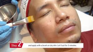 Avail the newest chemical peel for your Melasma. Book an...