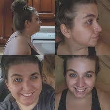 Loss of appetite after surgery common?