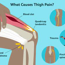 What is the whole purpose of a tendon? Thigh Pain Causes Treatment And When To See A Doctor