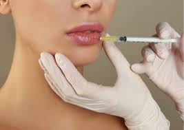 Why Does Lip Filler Migrate Above The Lip? - Kp Aesthetics | Anti-Wrinkle,  Dermal Filler, Laser & Skin Care Treatments %
