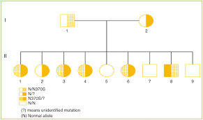 Gaucher Disease In A Family From Maranhao