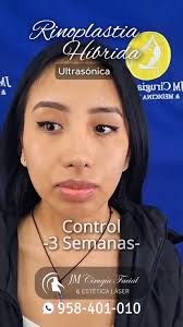 JM Cirugía Facial...