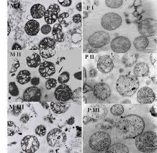 Maybe you would like to learn more about one of these? Ultrastructural Changes In Mitochondria And Peroxisomes From Pisum Download Scientific Diagram