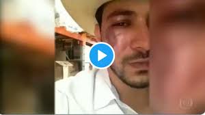 Assistir bbb 21 ao vivo online hd grátis 24 horas sem travar com todas as câmeras 24 horas grátis aqui no bbb 21 ao vivo é um reality show de edição número 21 do big brother brasil ao vivo. Caio Afiune Do Bbb21 Sofre Agressao Fisica Fica Com O Olho Roxo E Aparece Na Globo Com O Rosto Desfigurado Vem Conferir Enquete Bbb Votar Bbb 21
