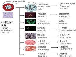 所以我拄着拐杖去了检查室 在那里 我的血液分析显示一切正常 除了crp 这远非正常 crp号码太高了以至于我无法相信 我的天哪 出了什么问题 我问 我立即去找了一位诊断我患有自身免疫性疾病的类风湿性关节炎专 cerebral palsy treatment the cure