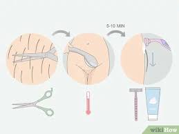 It opens the pores allowing the hair to grow freely. How To Get Rid Of Ingrown Pubic Hair With Pictures Wikihow