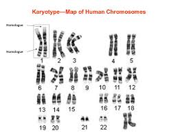 Human Chromosome Disorders Karyotype Map Of Human