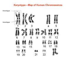 human chromosome disorders karyotype map of human