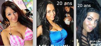Après un premier passage remarqué, elle avait participée dans plusieurs autres programmes en faisant enchaîner les émissions tv et les tapis rouges par ses mises. Nabilla Benattia Avant Apres Chirurgie Esthetique Les Celebrites Au Naturel Avant Apres